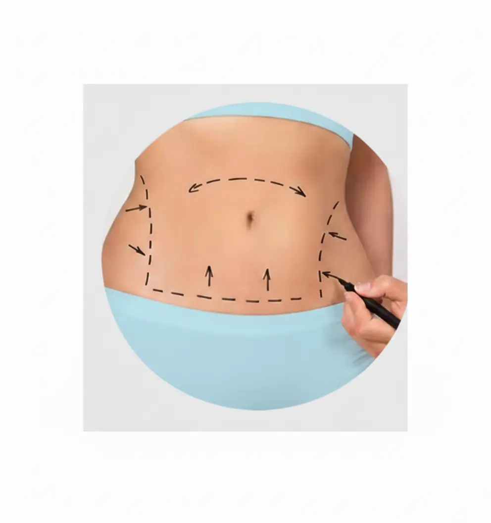 Body lift complet